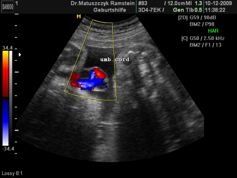 2009 Dec 10 Week 32 Ultrasounds